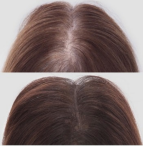 Viviscal Before And After